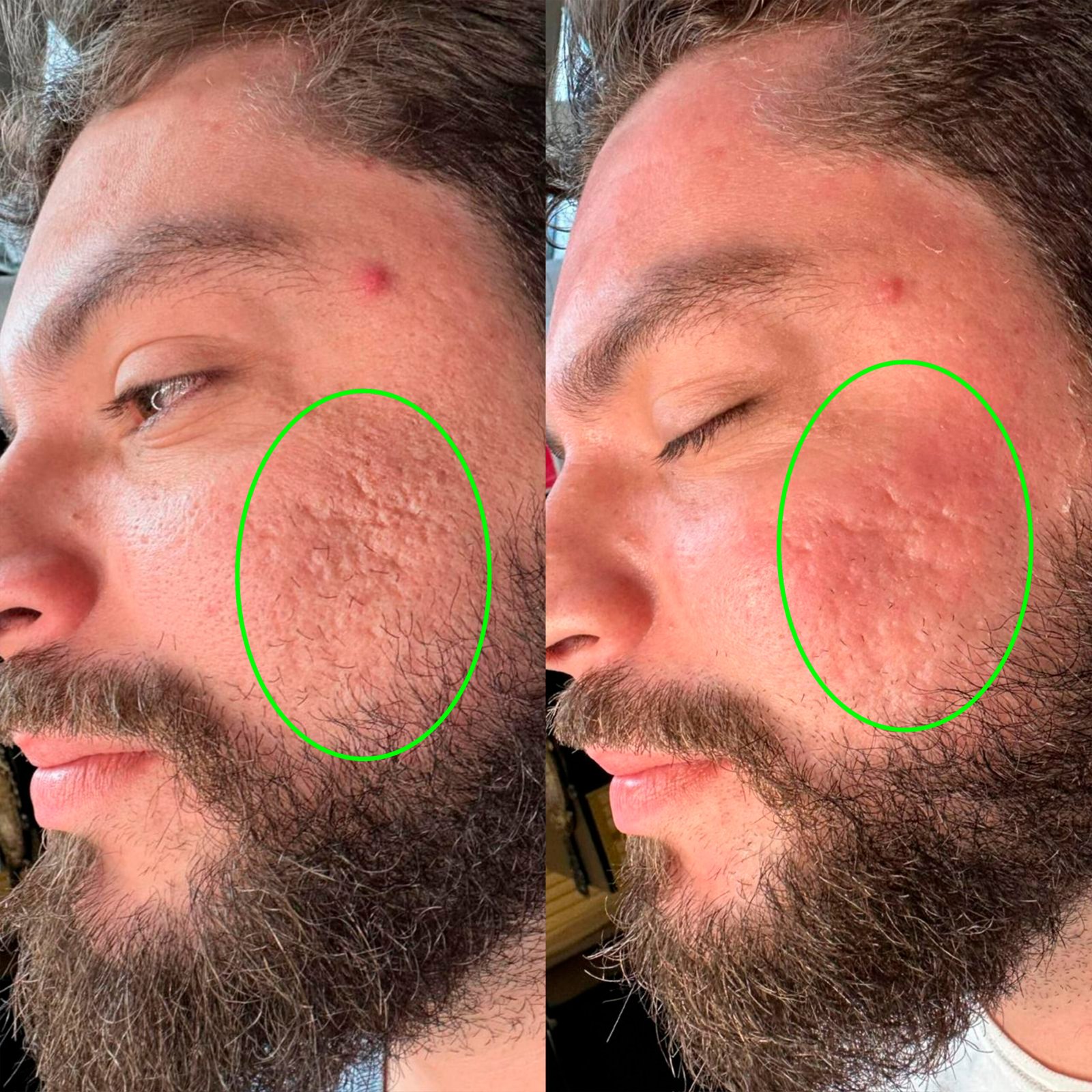 ANTES-E-DEPOIS-06