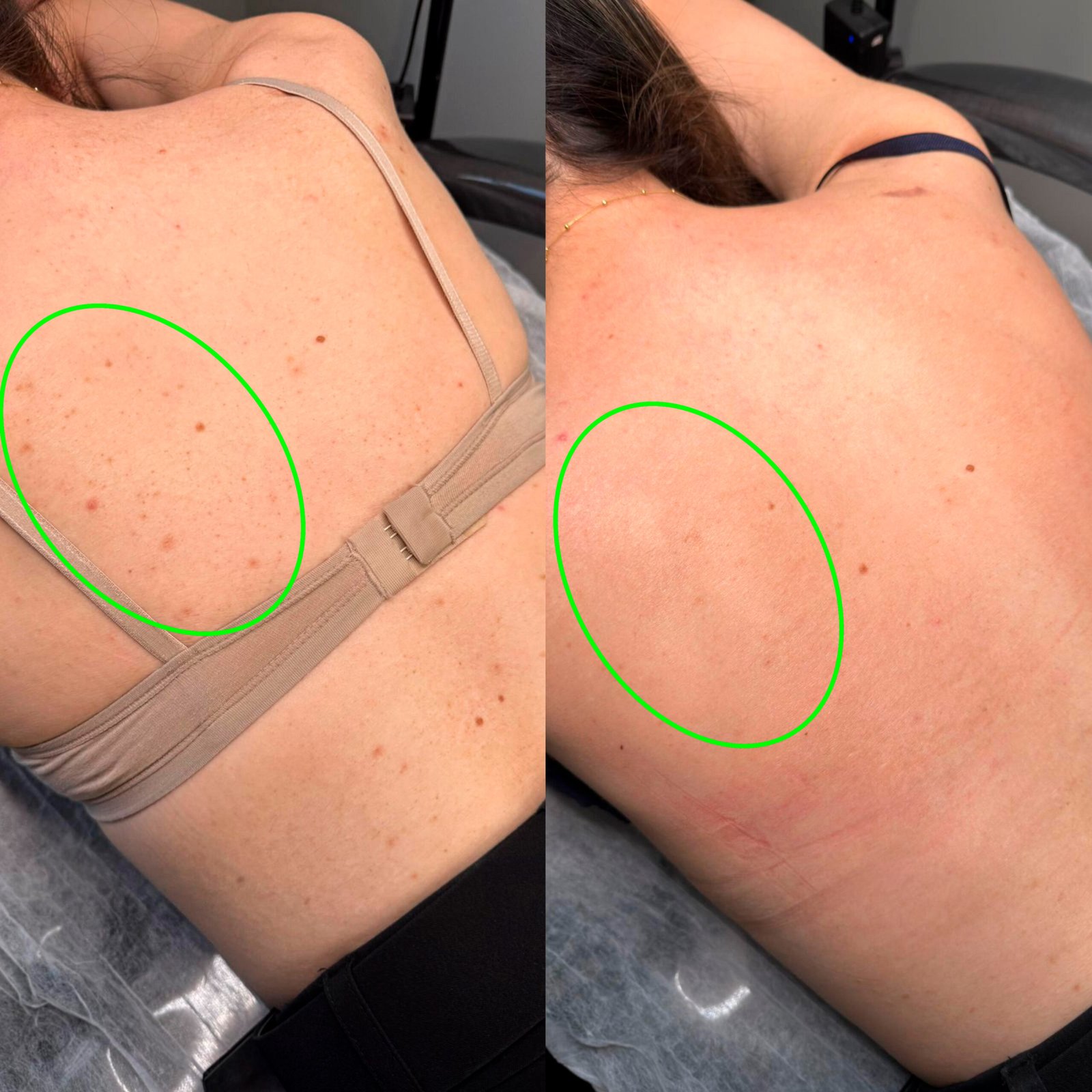 ANTES-E-DEPOIS-061