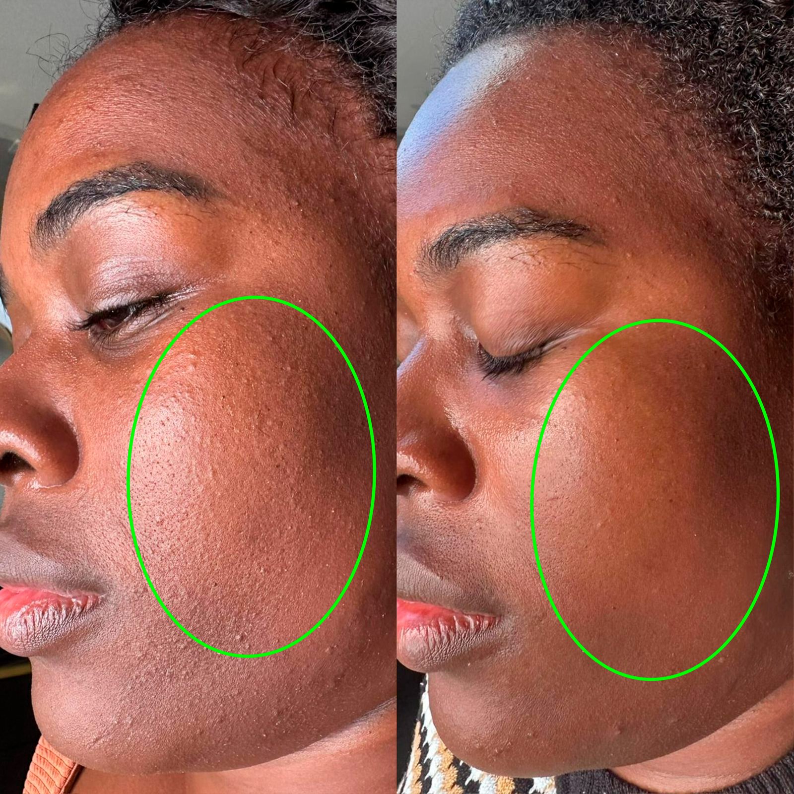 ANTES-E-DEPOIS-062