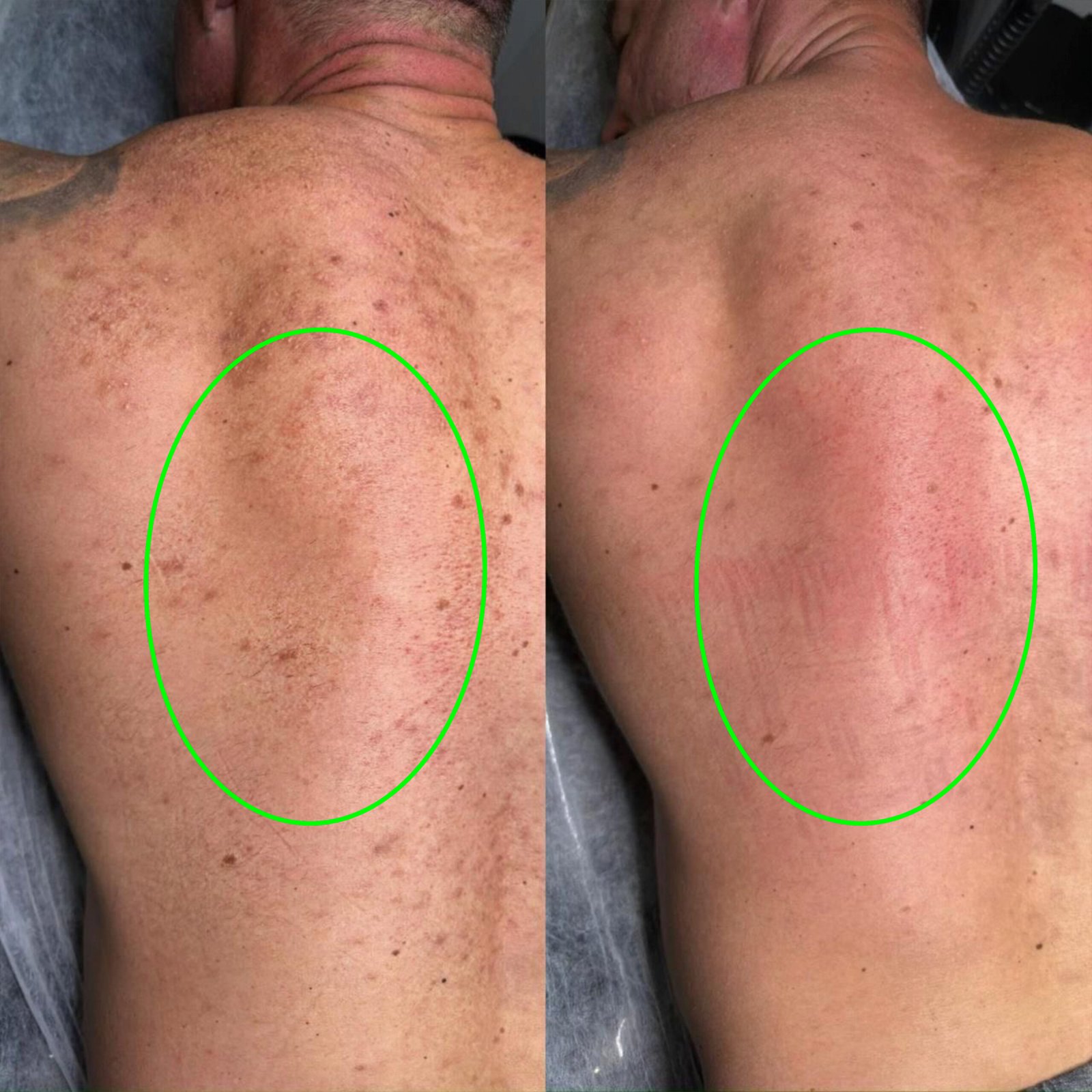 ANTES-E-DEPOIS-063