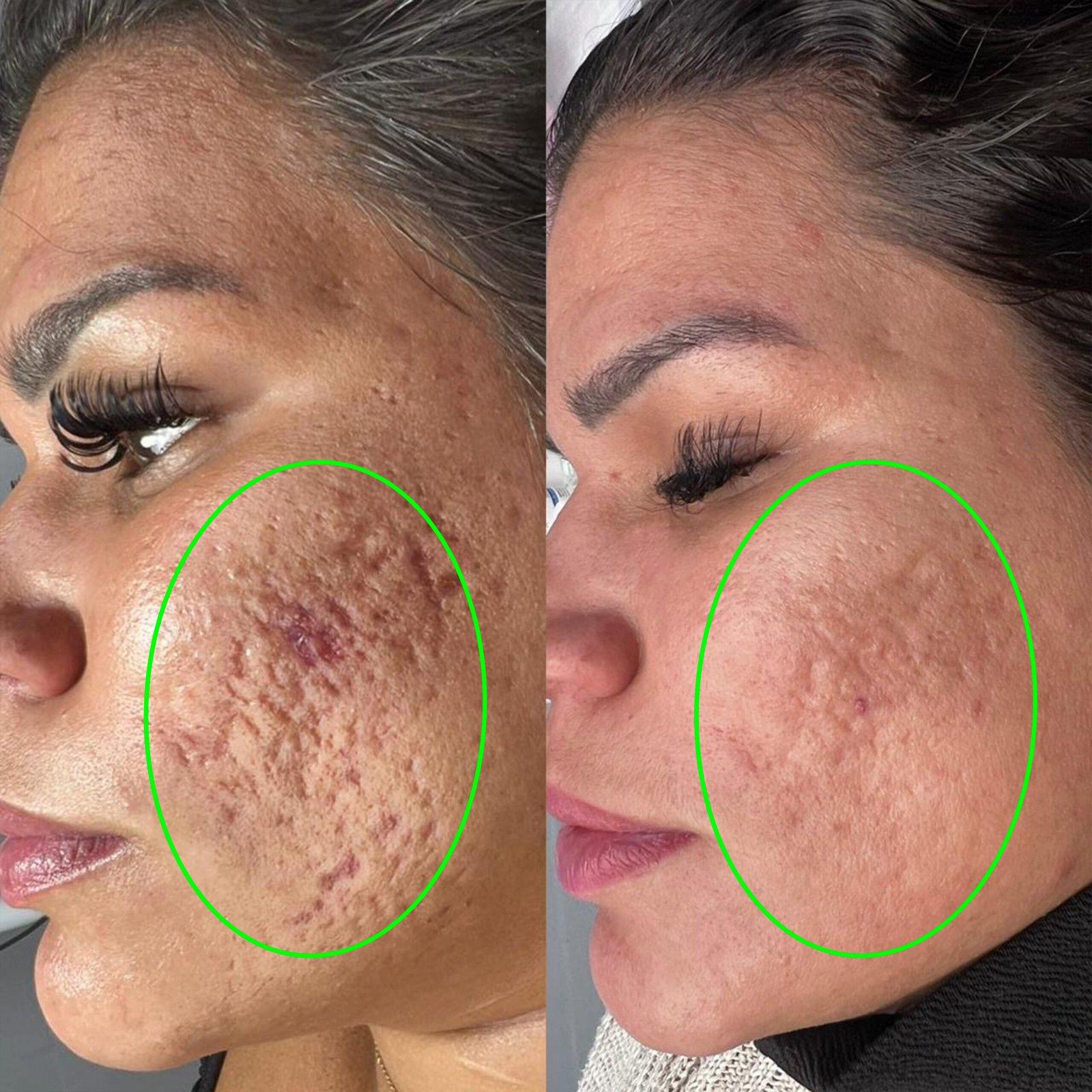 ANTES-E-DEPOIS-064